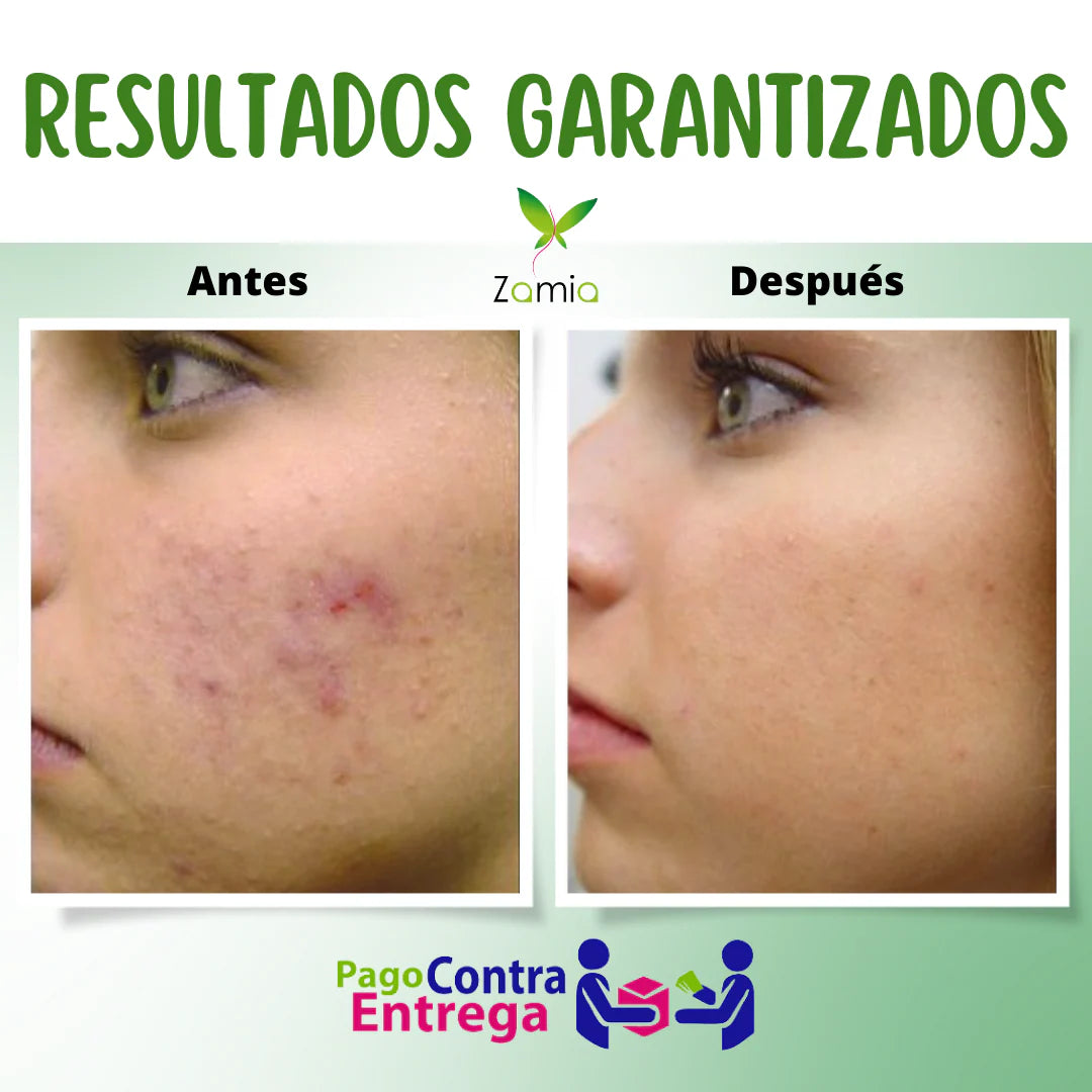 PROMO PERFECTA