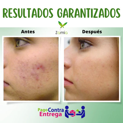 PROMO PERFECTA